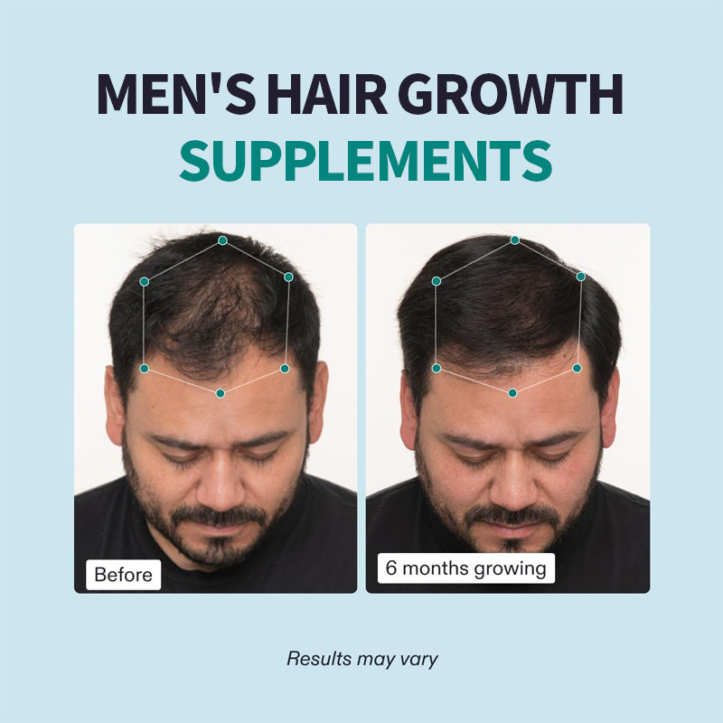 OEM Suppléments de croissance des cheveux pour hommes Capsules capillaires pour hommes Capsules capillaires pour hommes