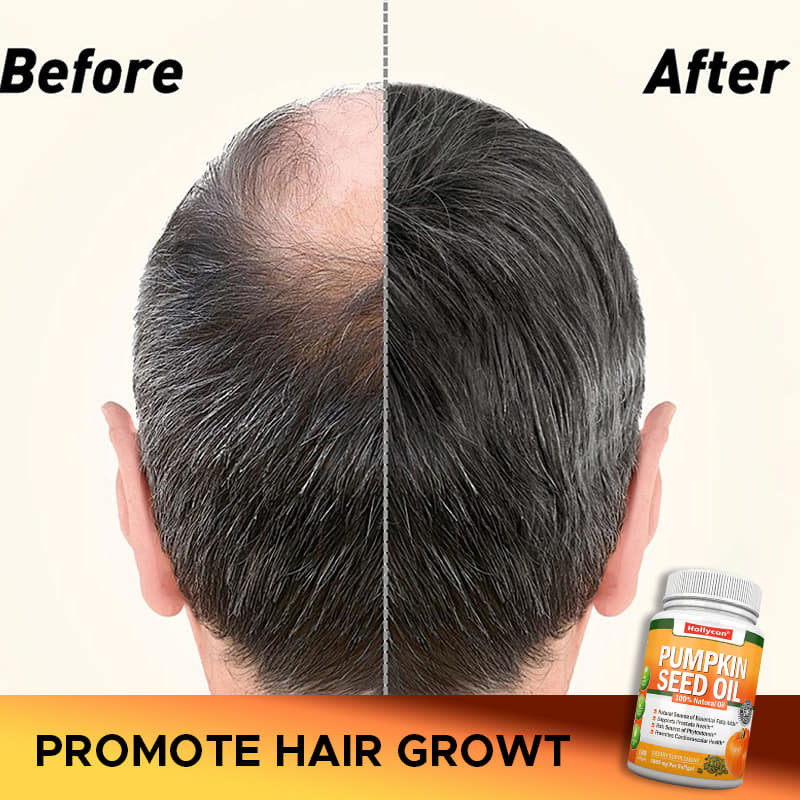 L' huile de graines de citrouille de l' usine Softgels Cheveux Santé des articulations de la prostate Oméga-3 Supplément d' acides gras essentiels